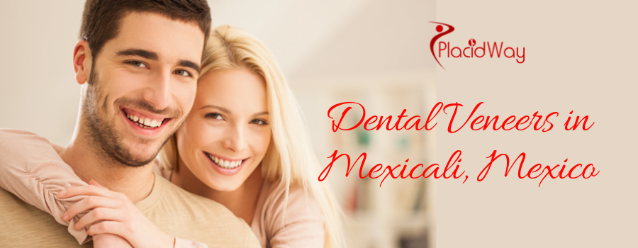 What is the Average Price of Dental Veneers in Mexicali, Mexico?
